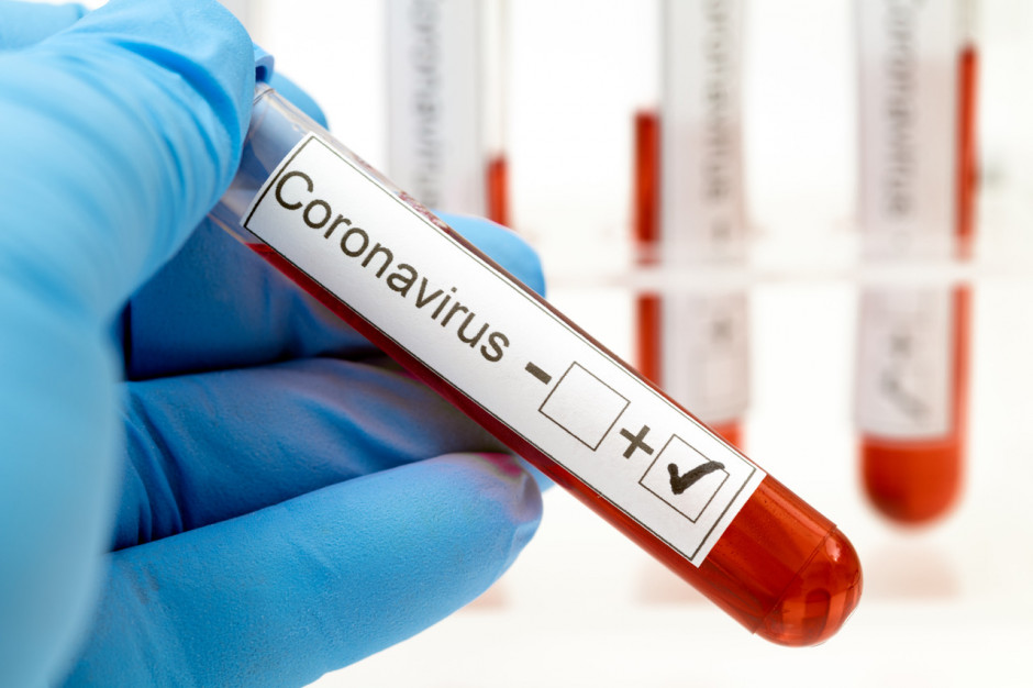 Punkty pobrań wykonujące test w kierunku zakażenia koronawirusem na zlecenie lekarza POZ